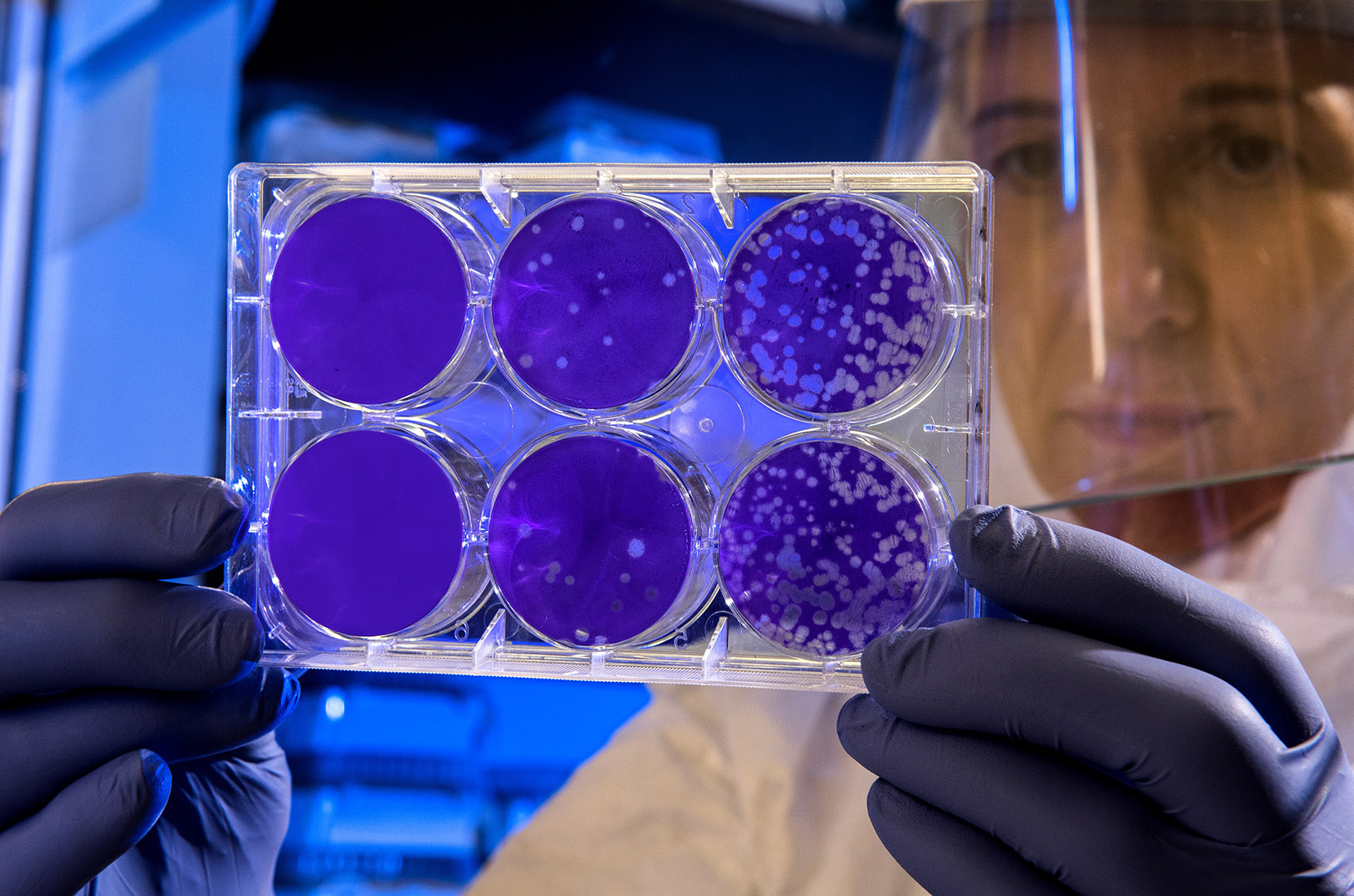 Fearing coronavirus? Don’t count out flu season — especially in these 10 ‘sickest’ cities