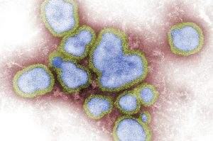 Influenza A, photo courtesy of the Centers for Disease Control